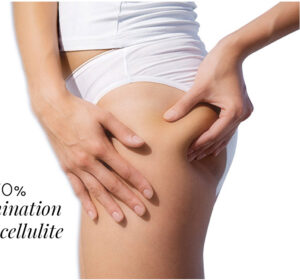 traitement anti-cellulite LPG