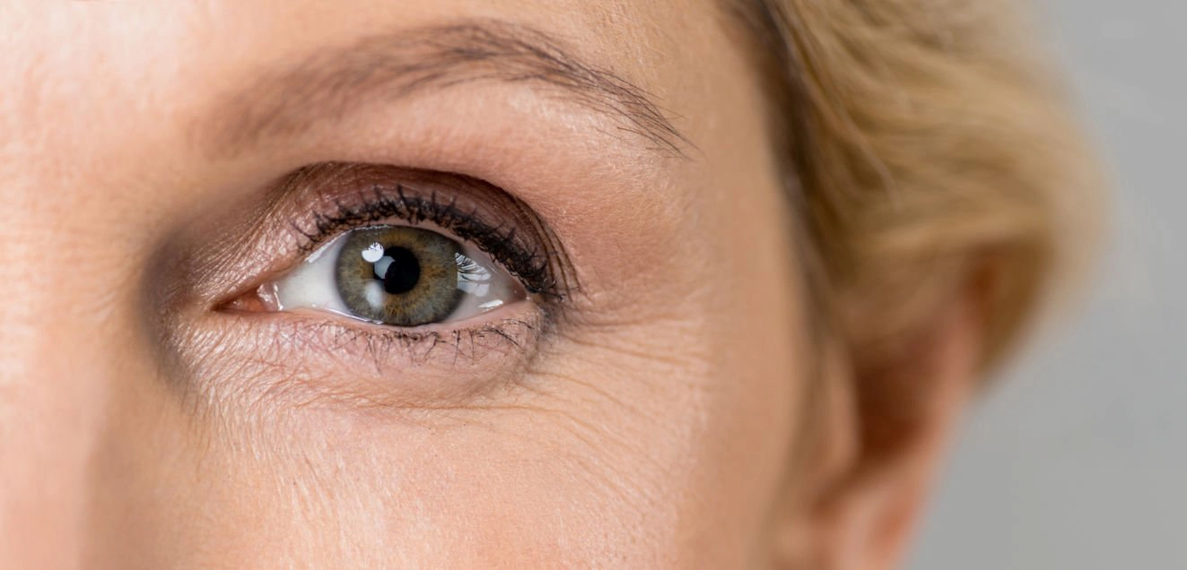 rides autour des yeux